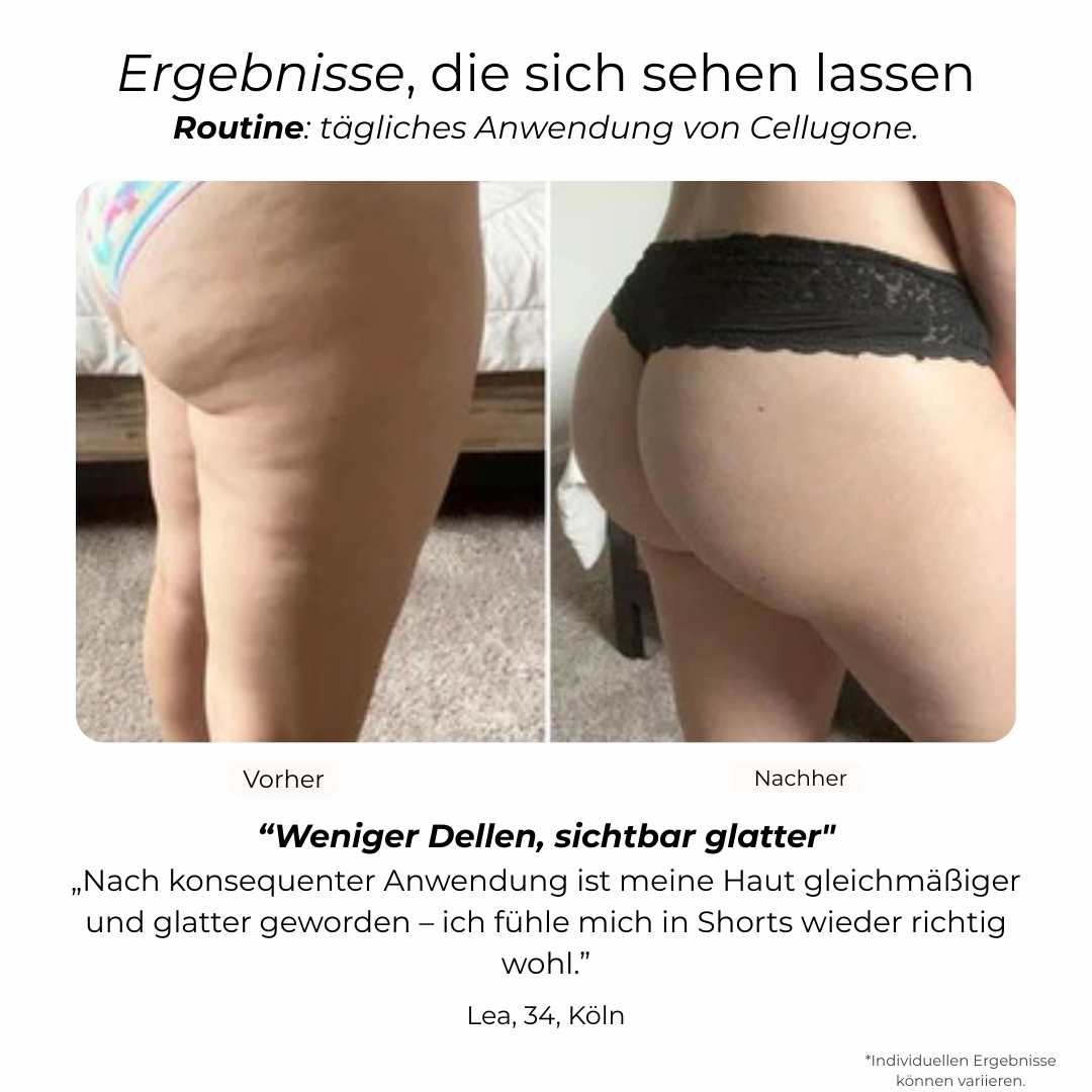 Cellugone 3.0 – Selfcare 3in1 Gerät