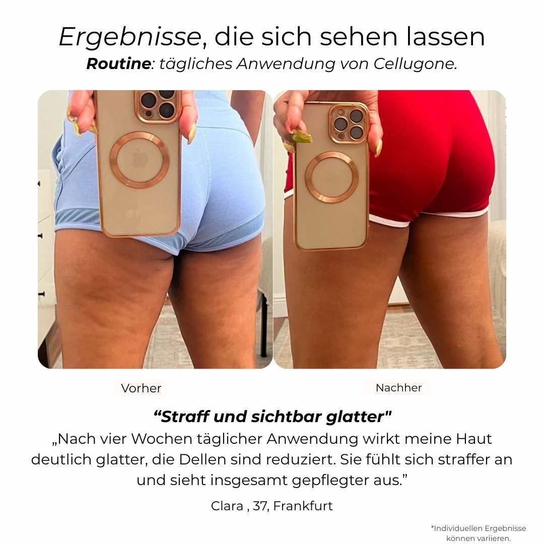Cellugone 3.0 – Selfcare 3in1 Gerät