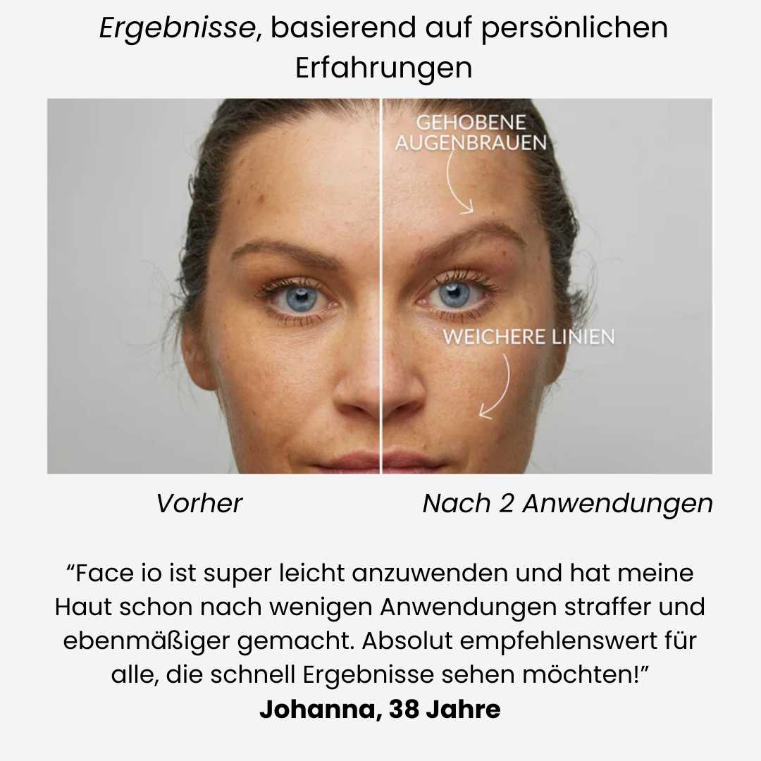 Face-iO Glätten, Straffen, Reinigen für strahlende Haut