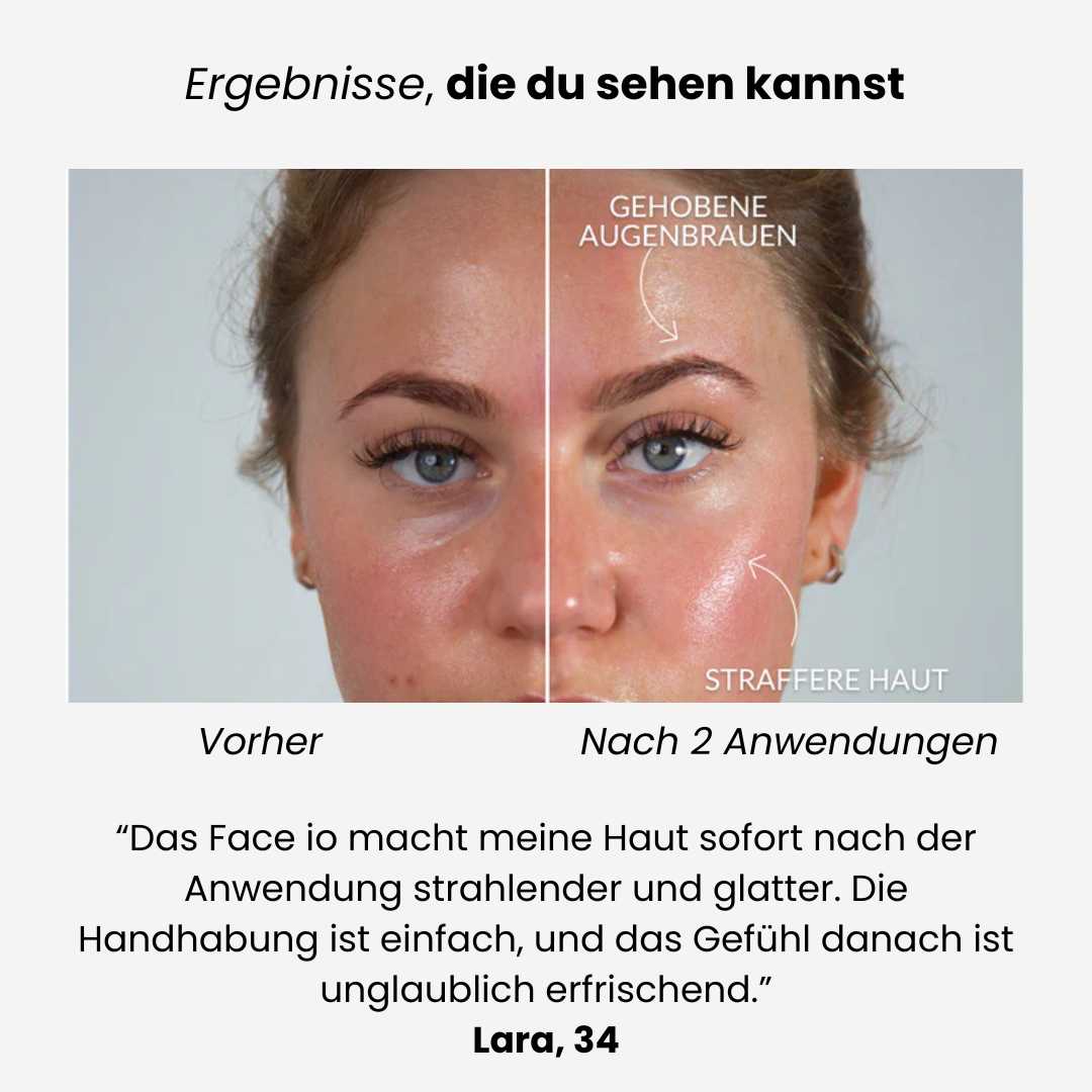 Face iO - Glätten, Straffen, Reinigen:  für strahlende Haut