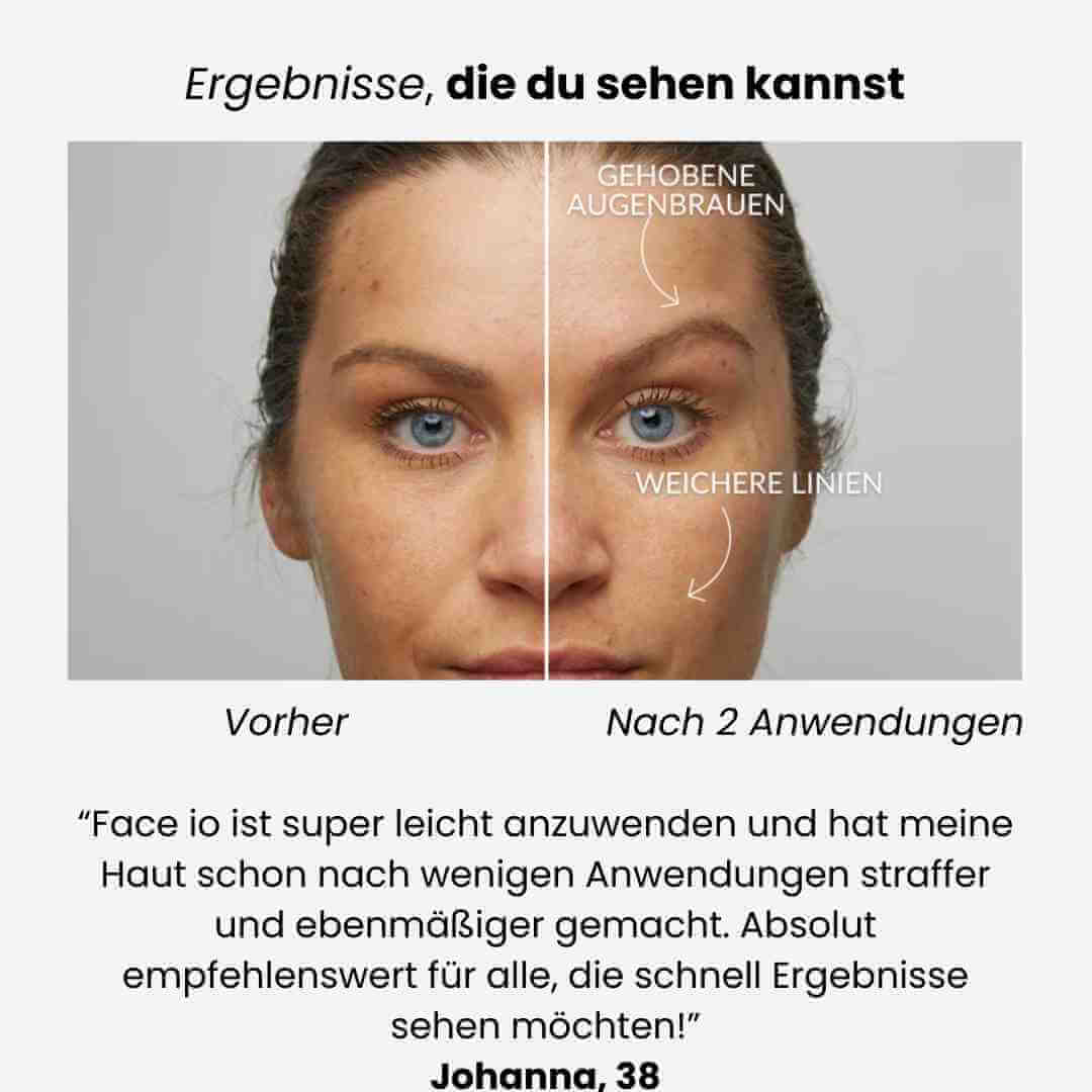 Face iO - Glätten, Straffen, Reinigen:  für strahlende Haut